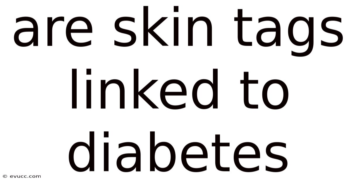Are Skin Tags Linked To Diabetes