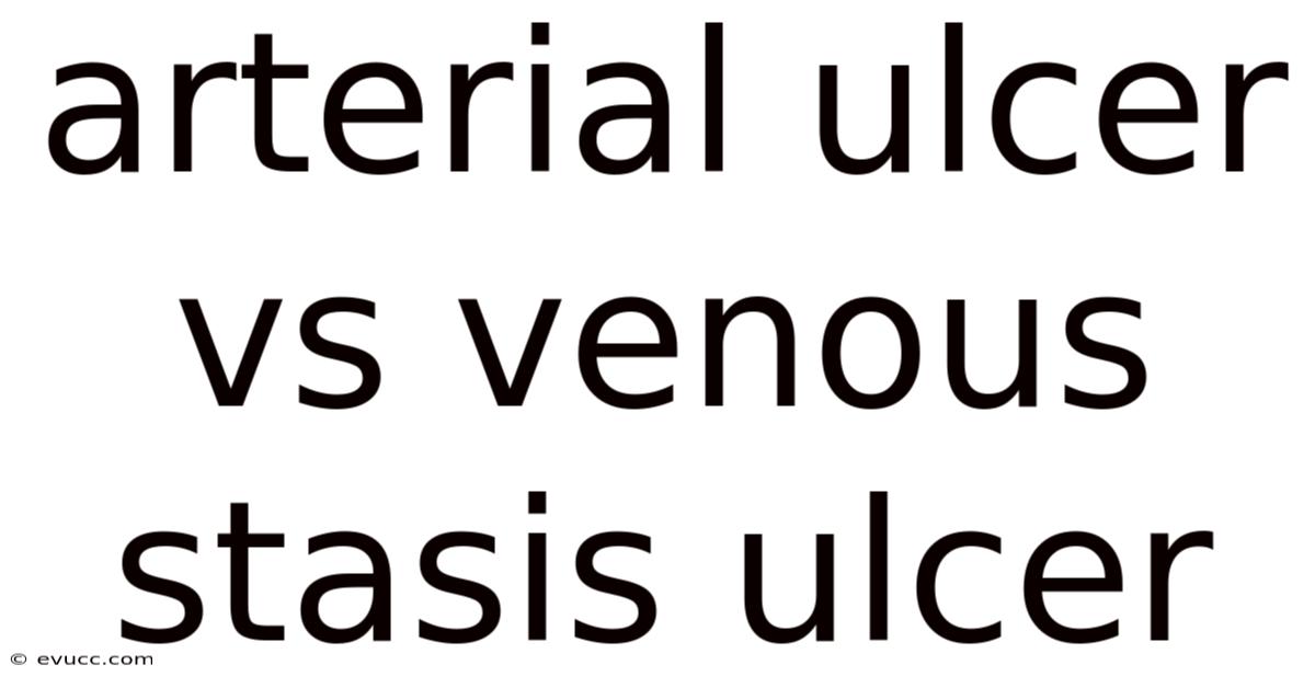 Arterial Ulcer Vs Venous Stasis Ulcer