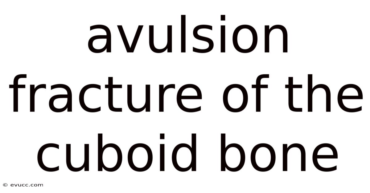 Avulsion Fracture Of The Cuboid Bone