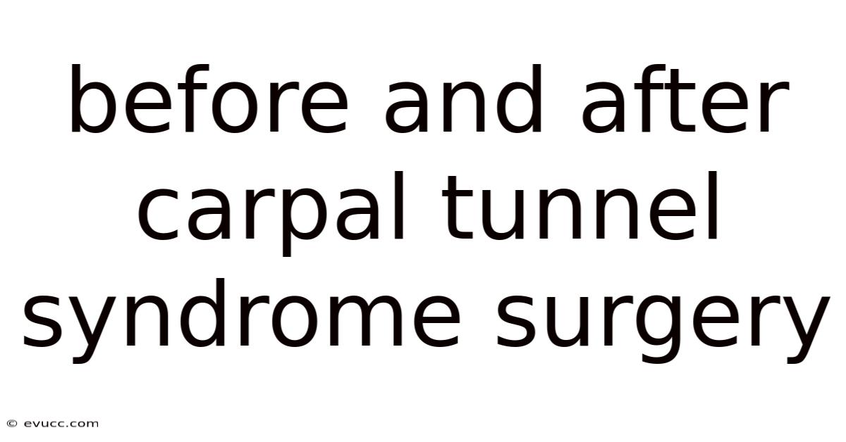 Before And After Carpal Tunnel Syndrome Surgery