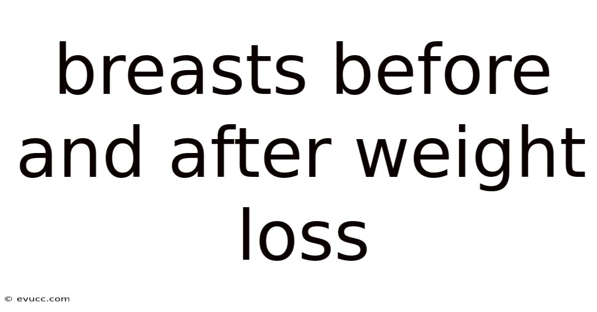 Breasts Before And After Weight Loss