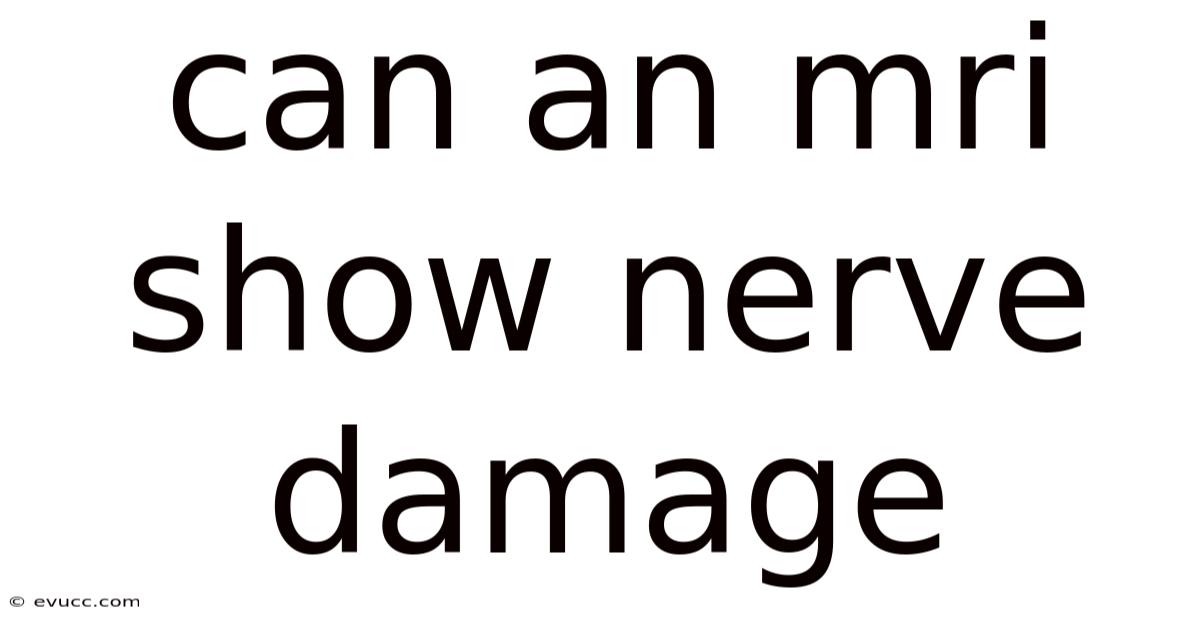 Can An Mri Show Nerve Damage