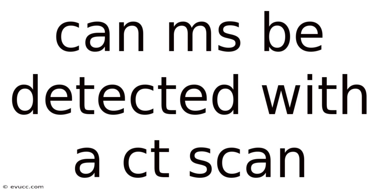 Can Ms Be Detected With A Ct Scan