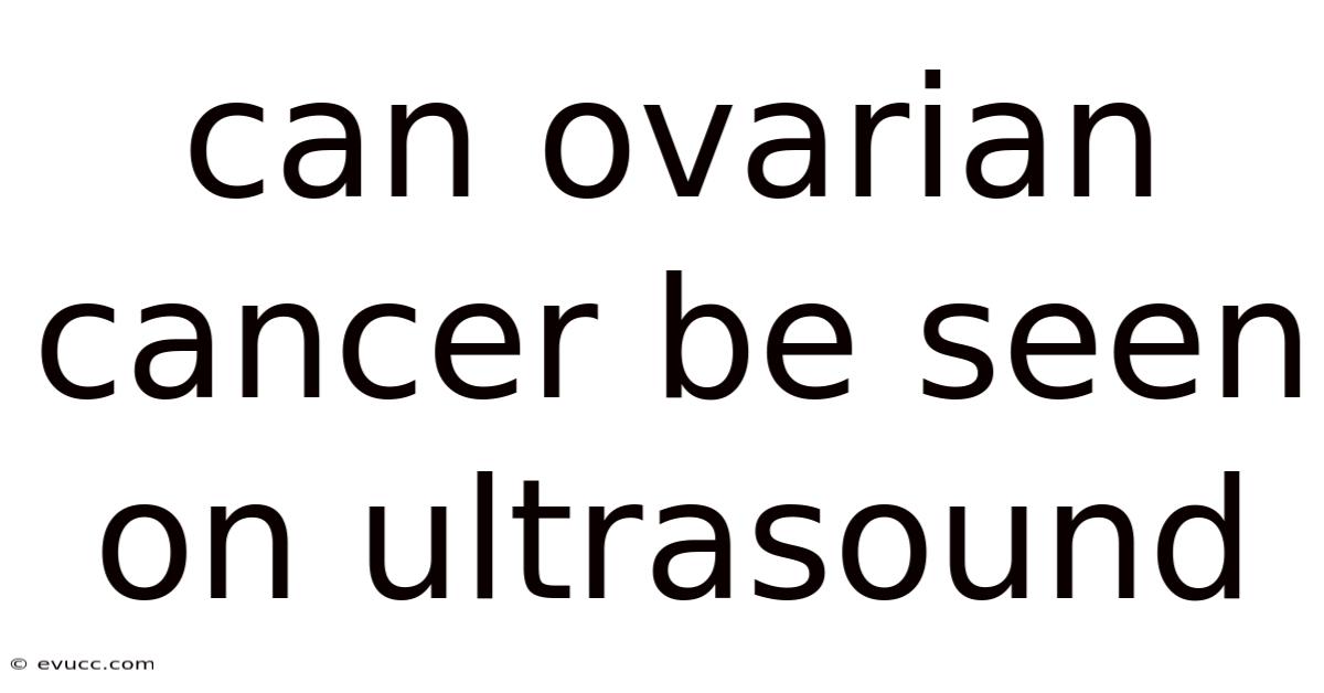 Can Ovarian Cancer Be Seen On Ultrasound