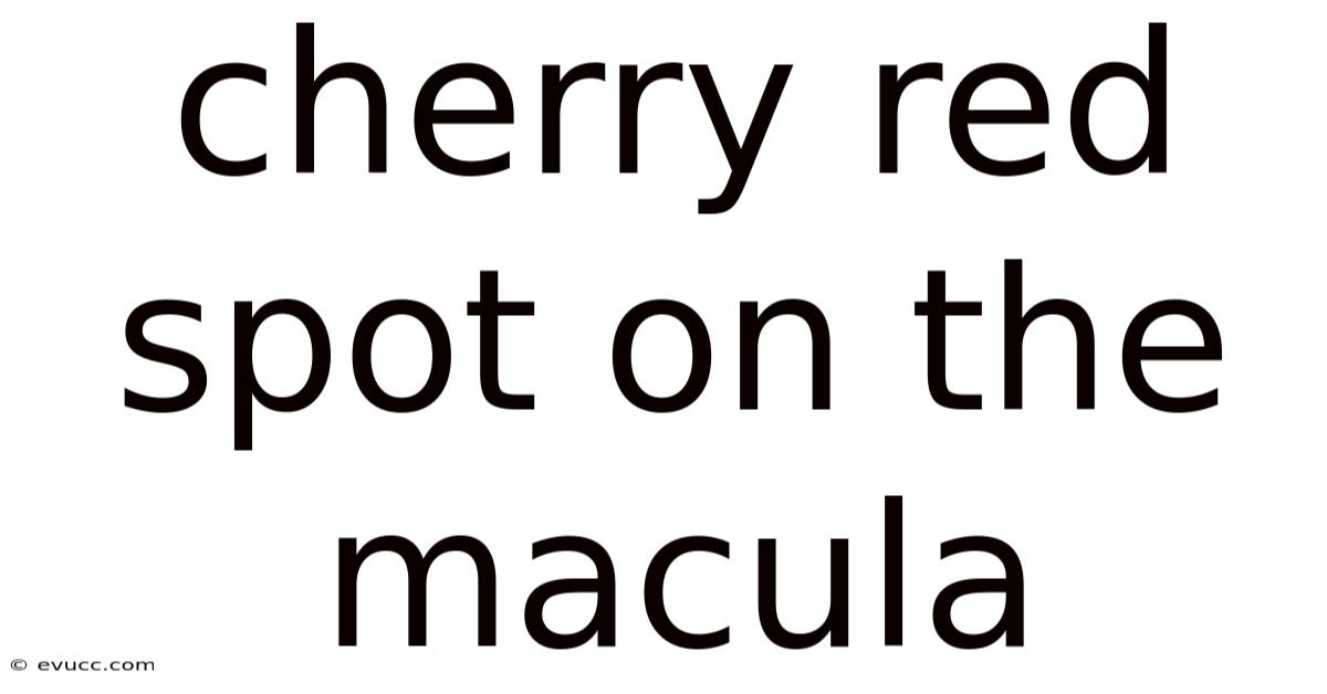 Cherry Red Spot On The Macula