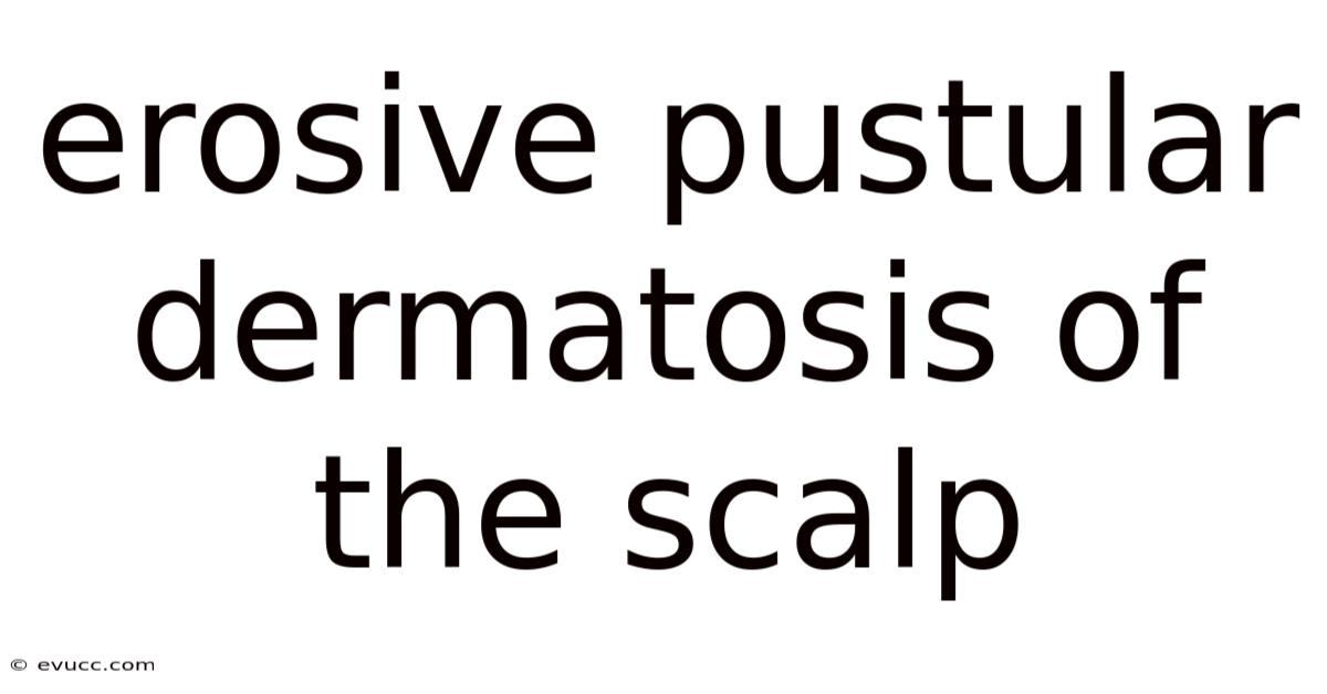 Erosive Pustular Dermatosis Of The Scalp