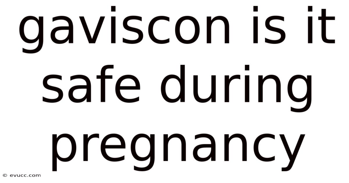 Gaviscon Is It Safe During Pregnancy
