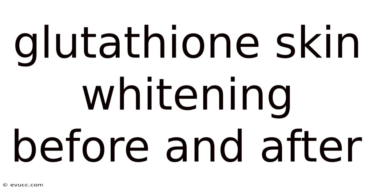 Glutathione Skin Whitening Before And After