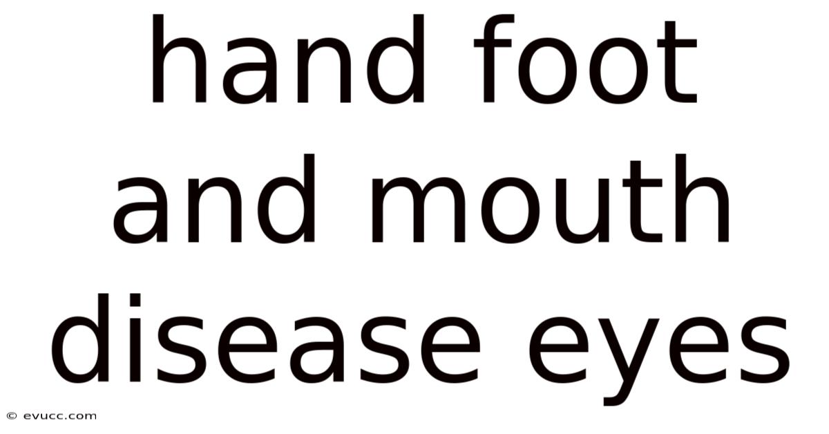 Hand Foot And Mouth Disease Eyes