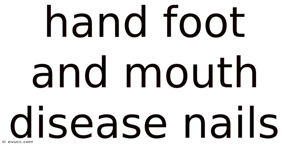 Hand Foot And Mouth Disease Nails