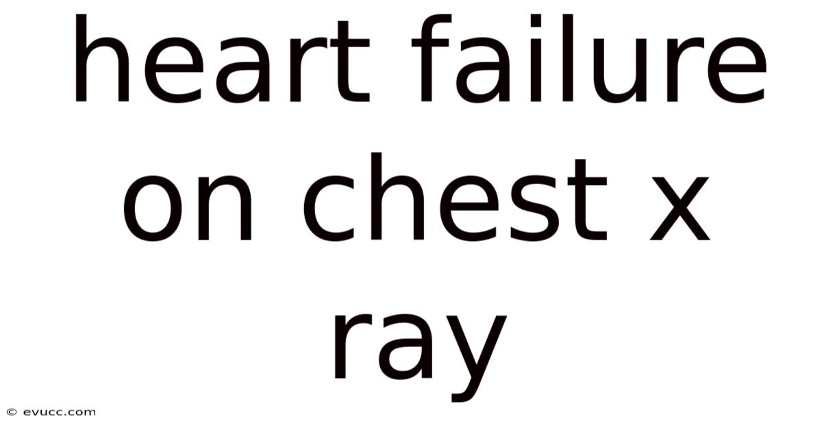 Heart Failure On Chest X Ray