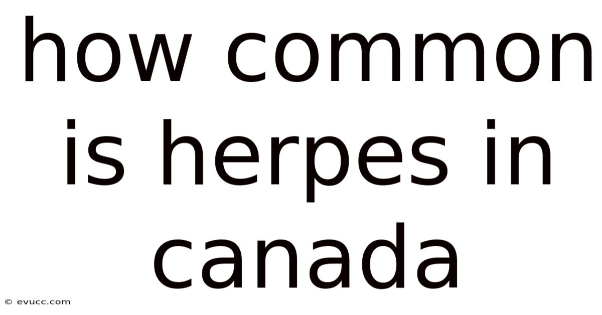 How Common Is Herpes In Canada