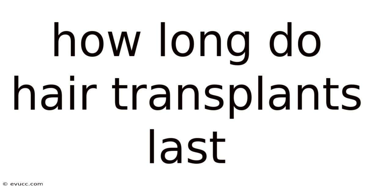 How Long Do Hair Transplants Last