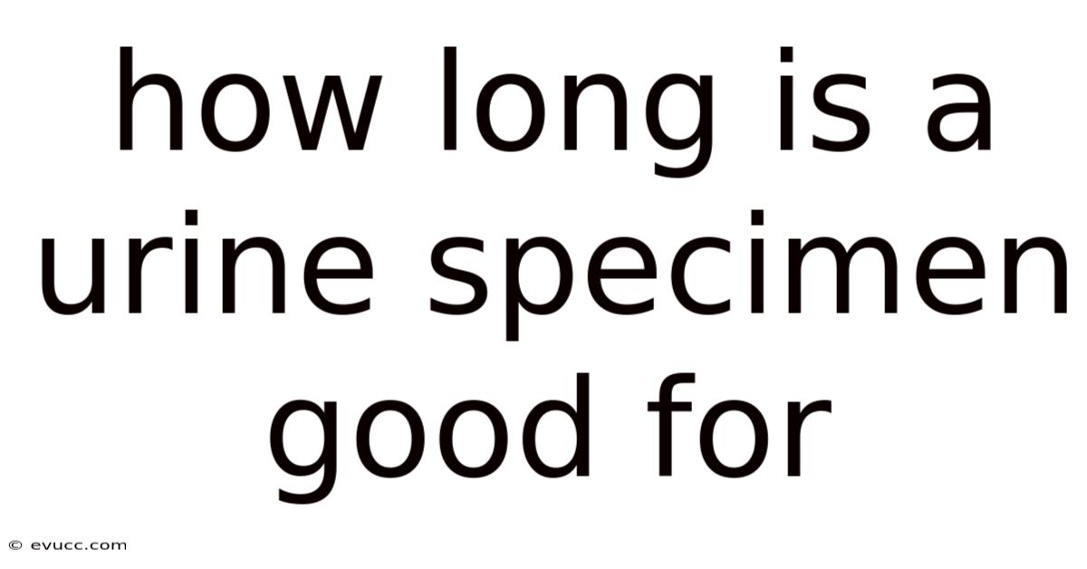 How Long Is A Urine Specimen Good For