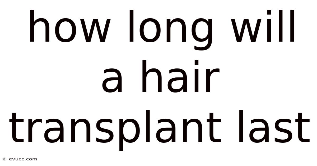How Long Will A Hair Transplant Last