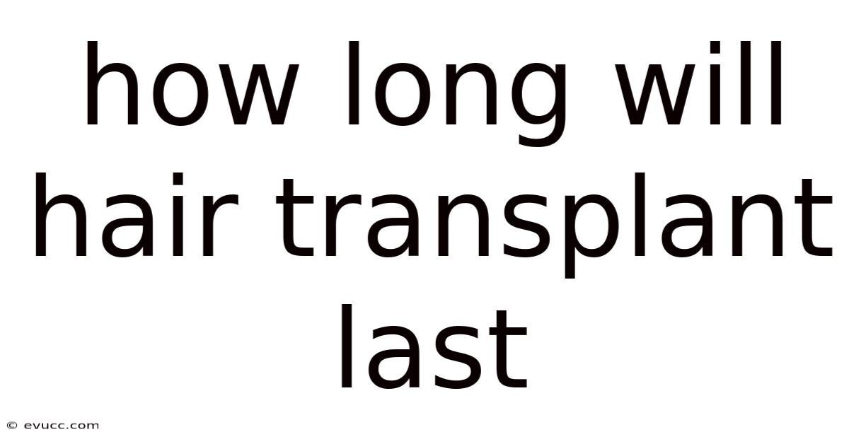 How Long Will Hair Transplant Last