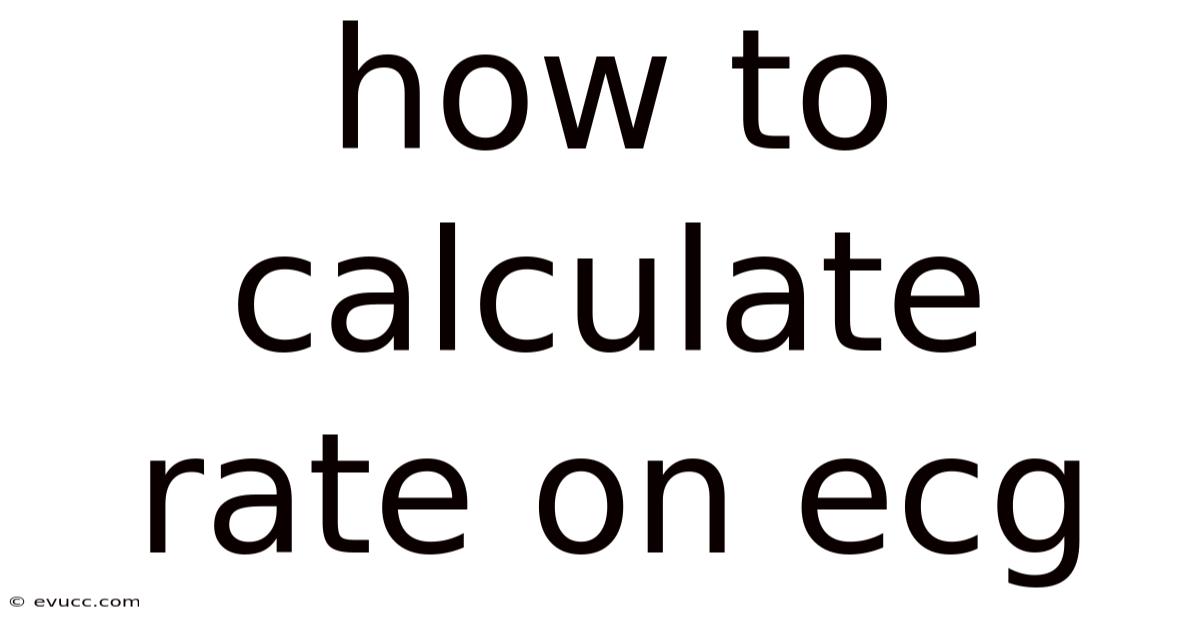 How To Calculate Rate On Ecg