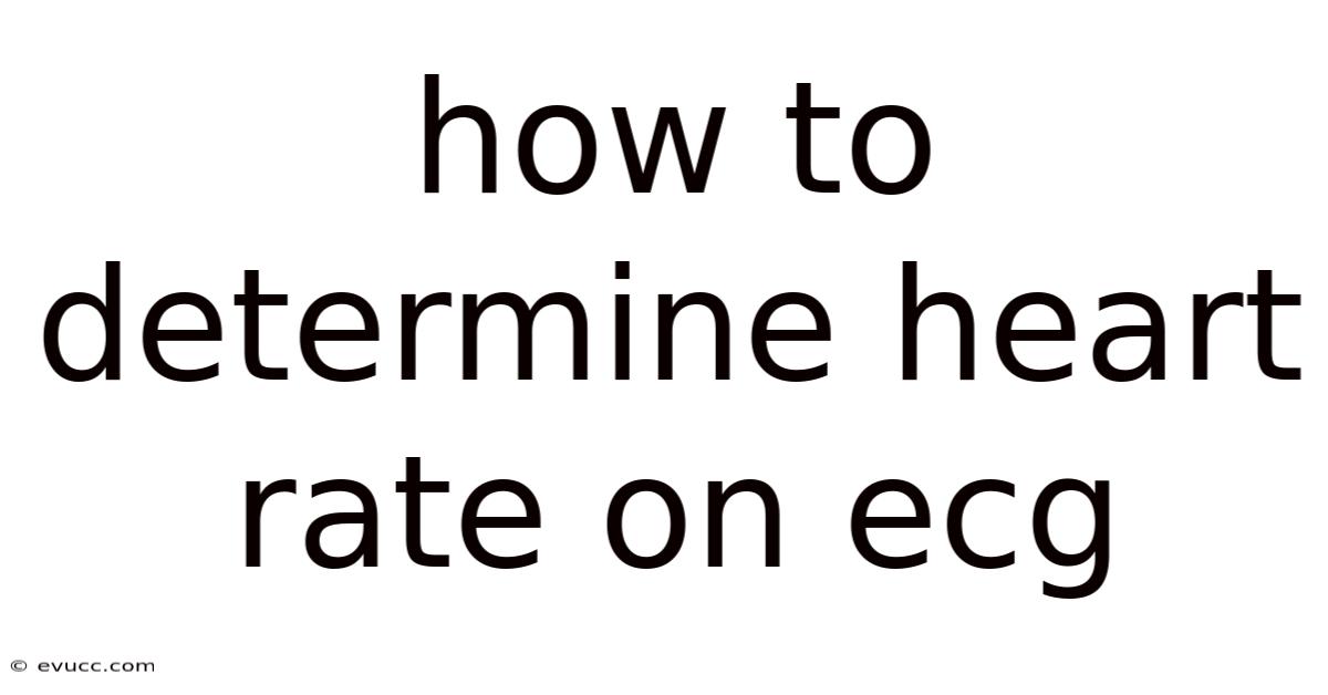 How To Determine Heart Rate On Ecg