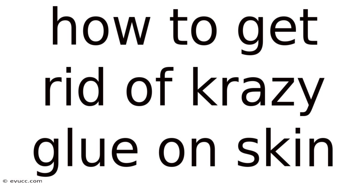 How To Get Rid Of Krazy Glue On Skin