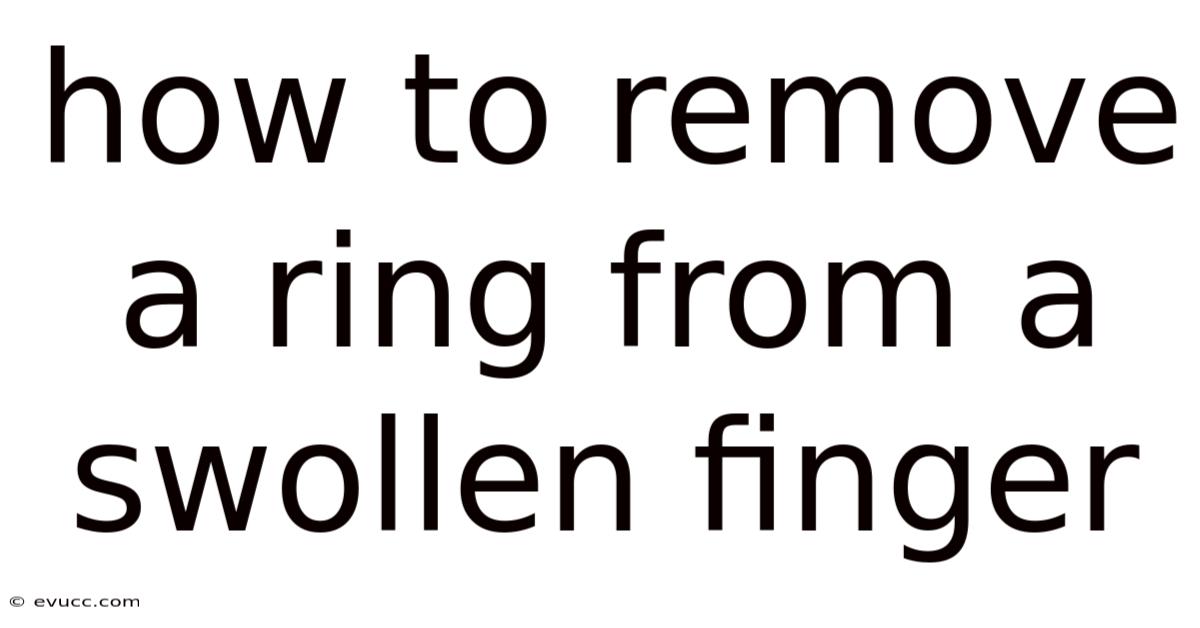 How To Remove A Ring From A Swollen Finger