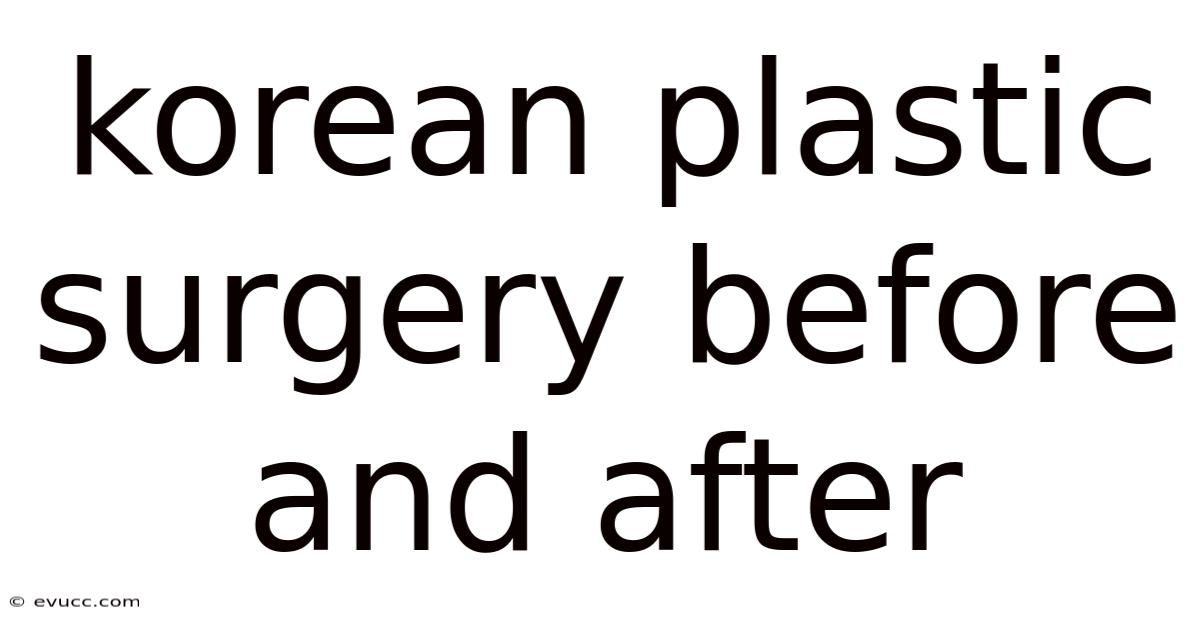 Korean Plastic Surgery Before And After