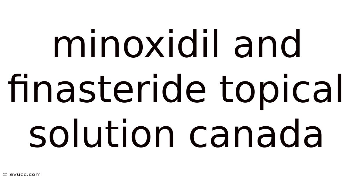 Minoxidil And Finasteride Topical Solution Canada