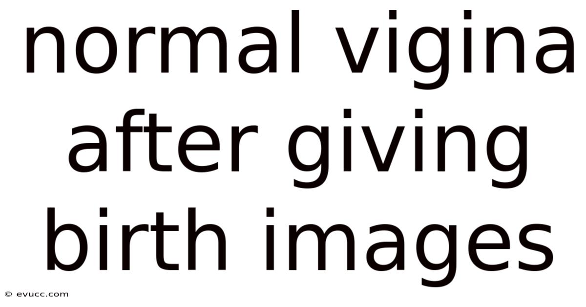 Normal Vigina After Giving Birth Images