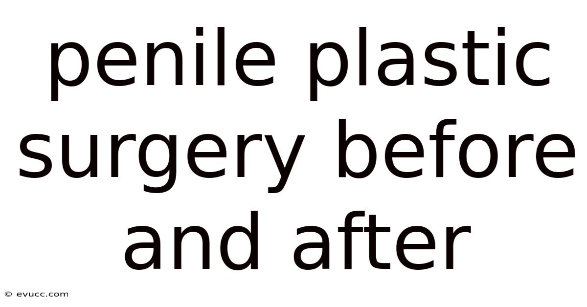 Penile Plastic Surgery Before And After