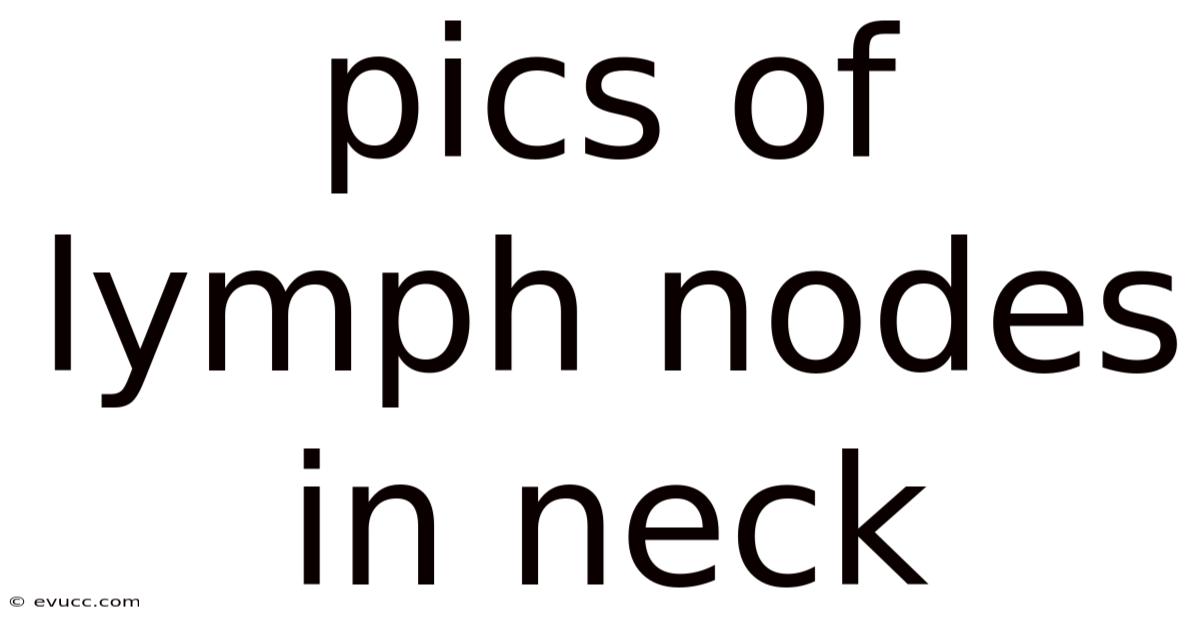 Pics Of Lymph Nodes In Neck