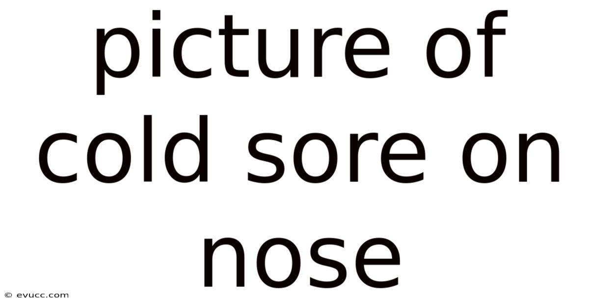 Picture Of Cold Sore On Nose
