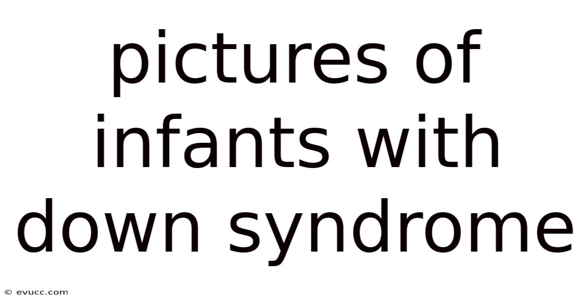 Pictures Of Infants With Down Syndrome