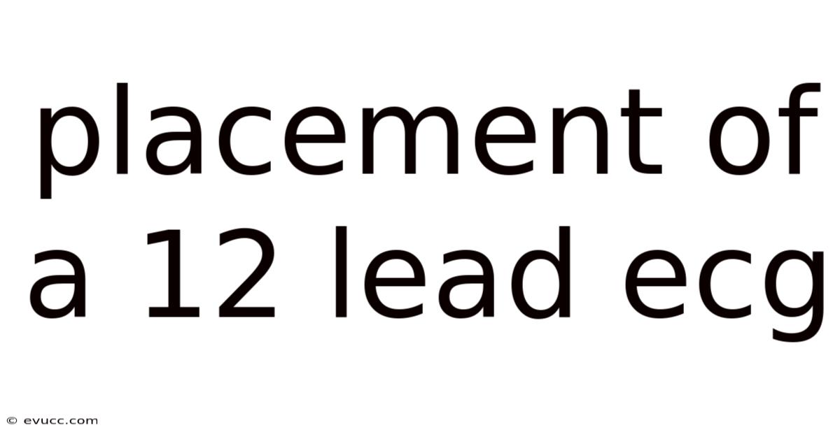 Placement Of A 12 Lead Ecg