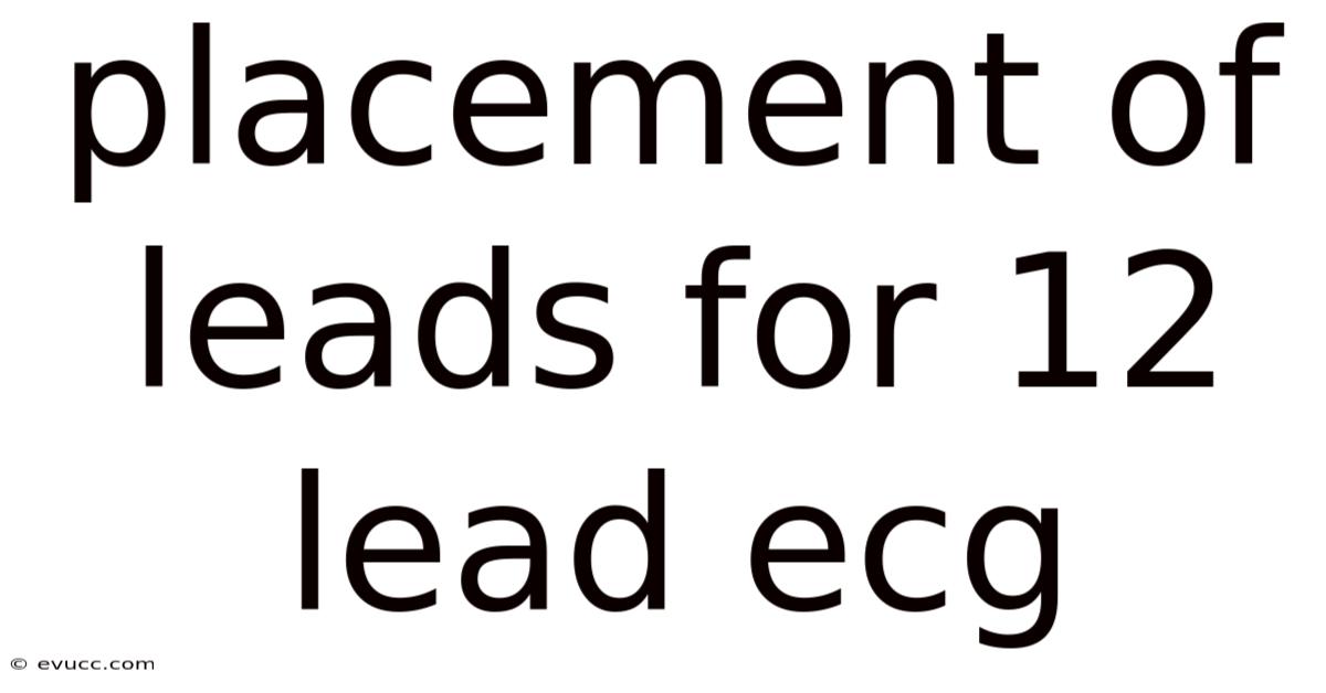 Placement Of Leads For 12 Lead Ecg