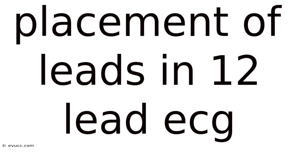 Placement Of Leads In 12 Lead Ecg