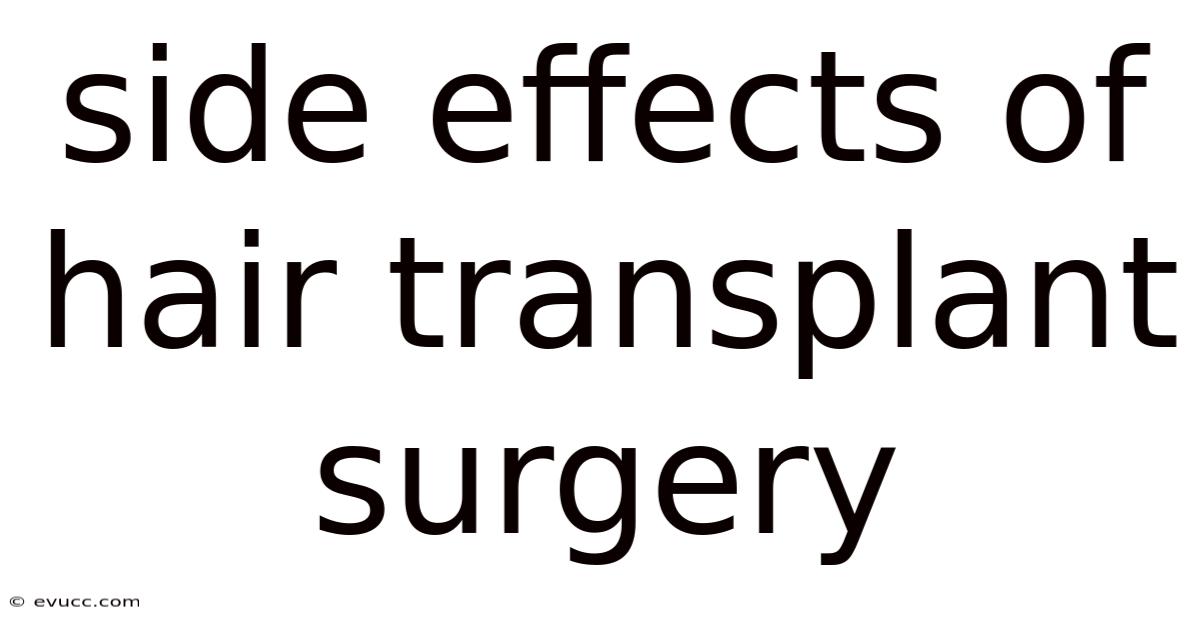 Side Effects Of Hair Transplant Surgery