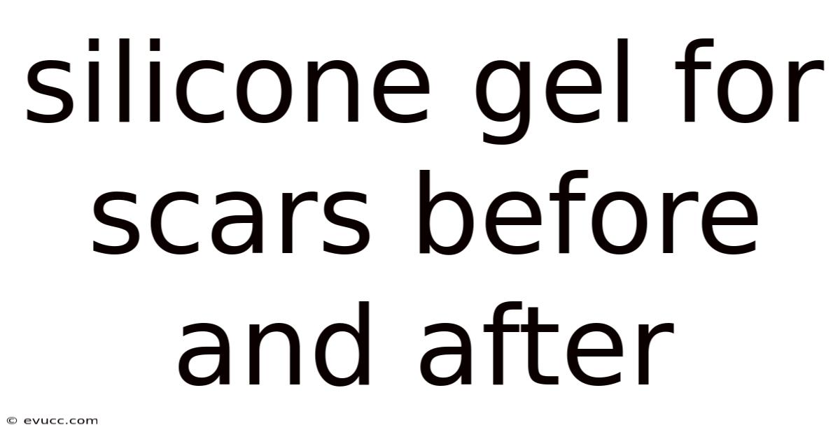 Silicone Gel For Scars Before And After