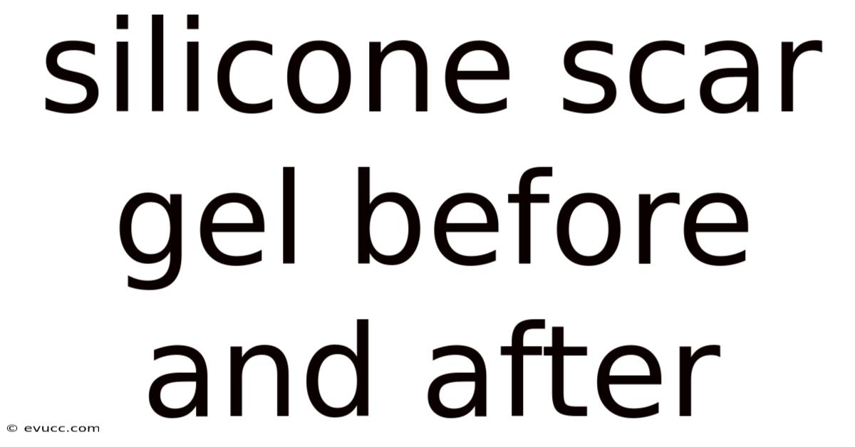 Silicone Scar Gel Before And After