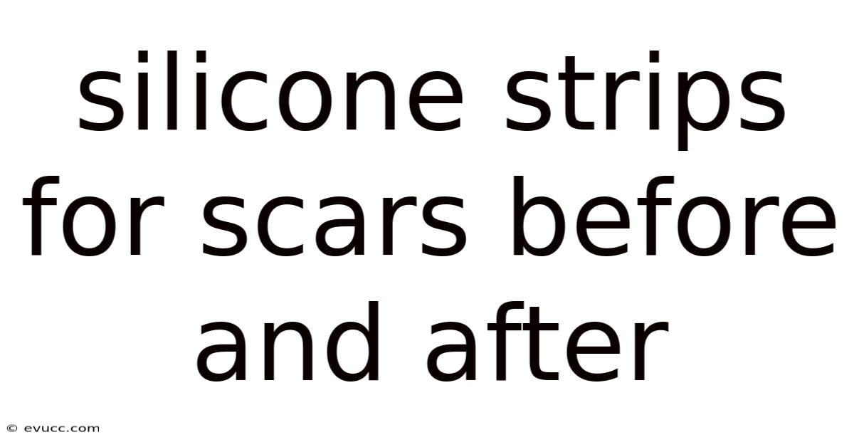 Silicone Strips For Scars Before And After