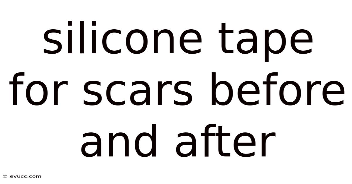 Silicone Tape For Scars Before And After