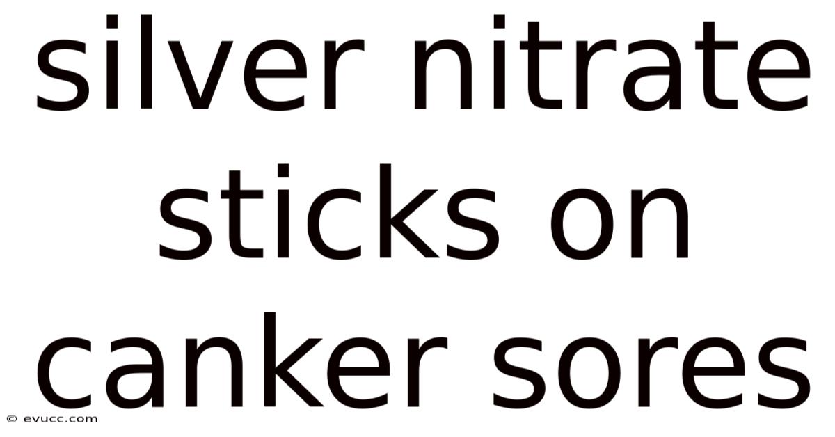 Silver Nitrate Sticks On Canker Sores