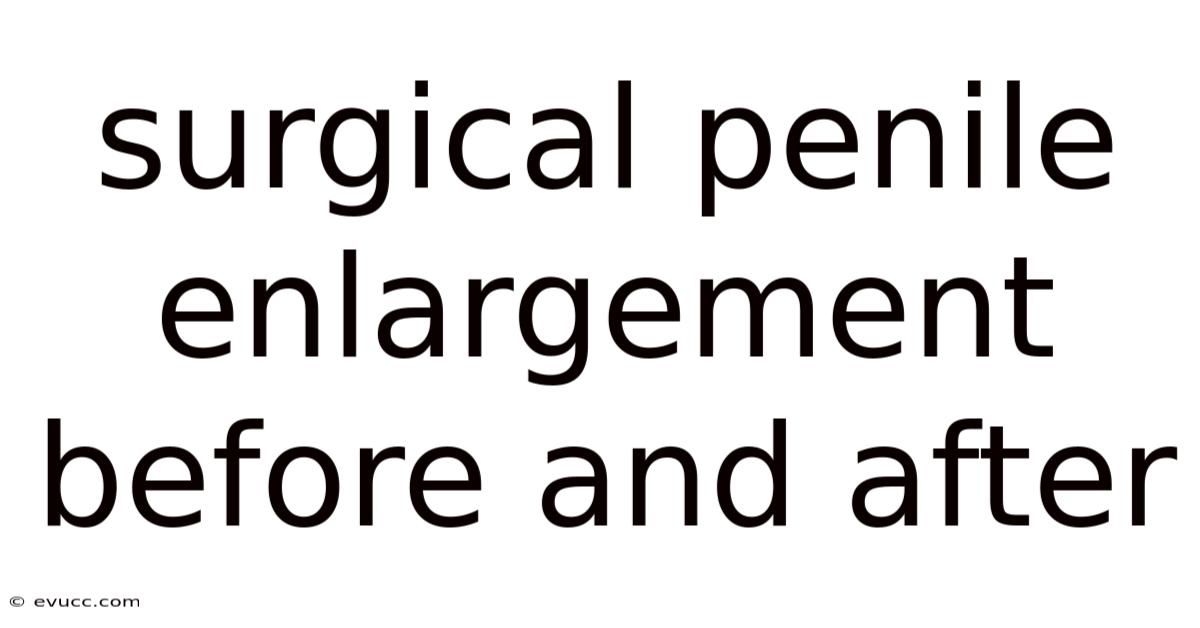 Surgical Penile Enlargement Before And After