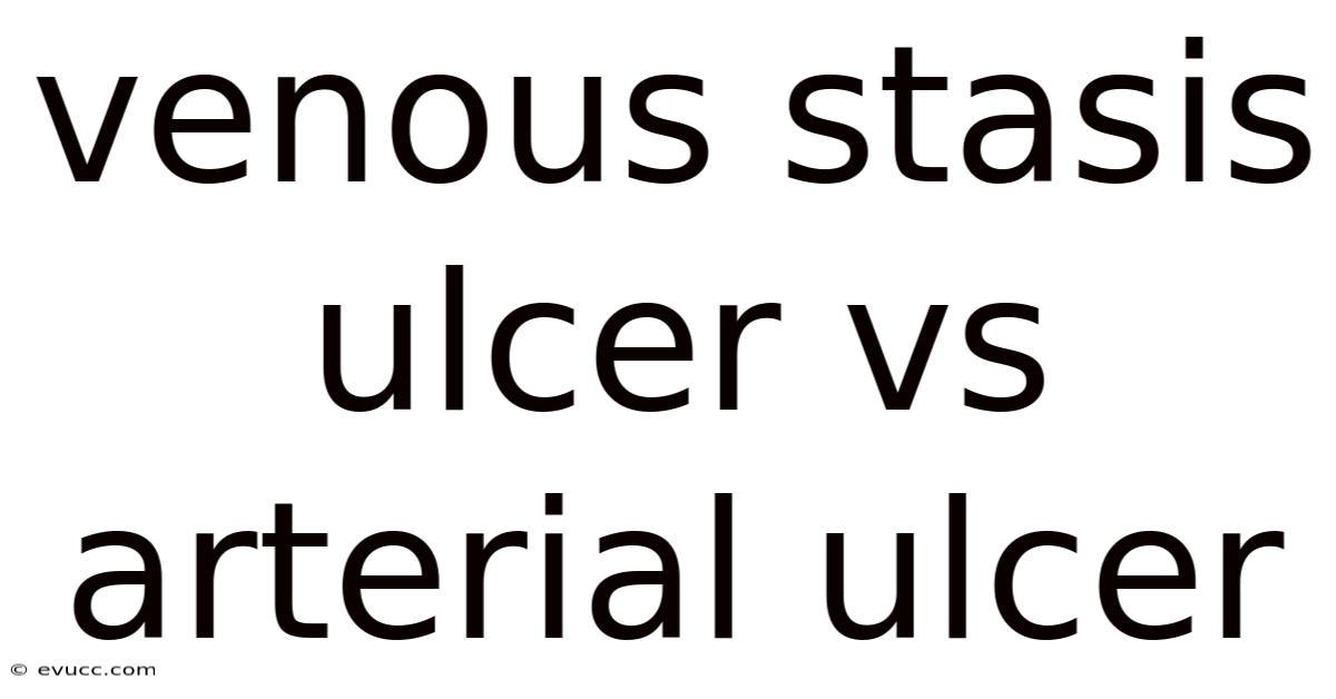 Venous Stasis Ulcer Vs Arterial Ulcer