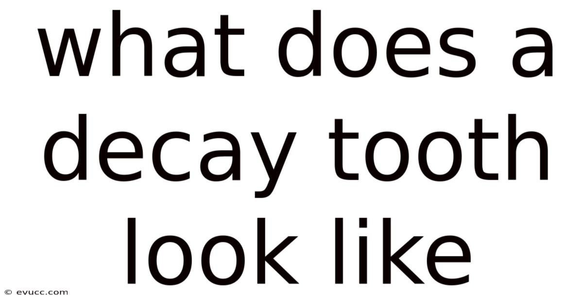 What Does A Decay Tooth Look Like