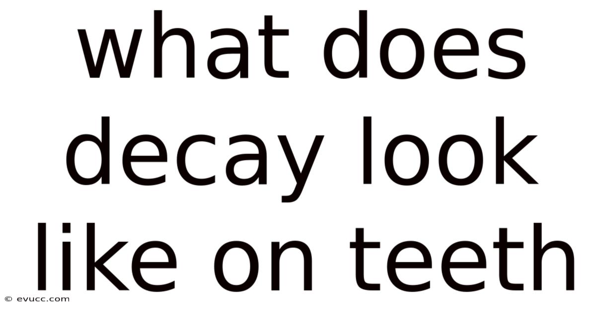 What Does Decay Look Like On Teeth