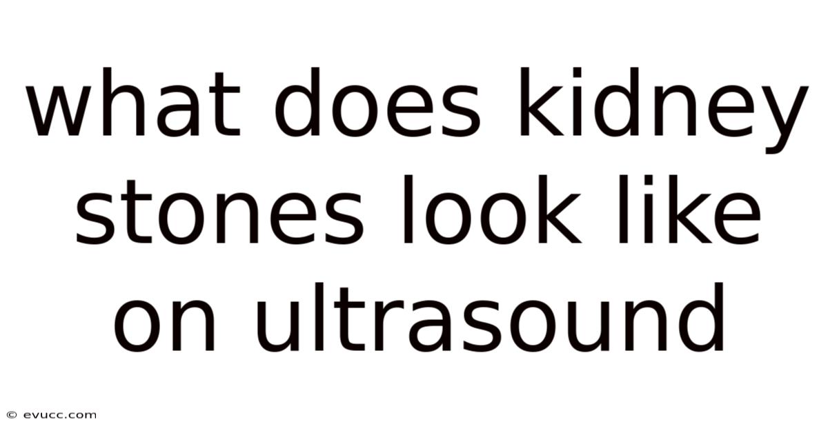What Does Kidney Stones Look Like On Ultrasound