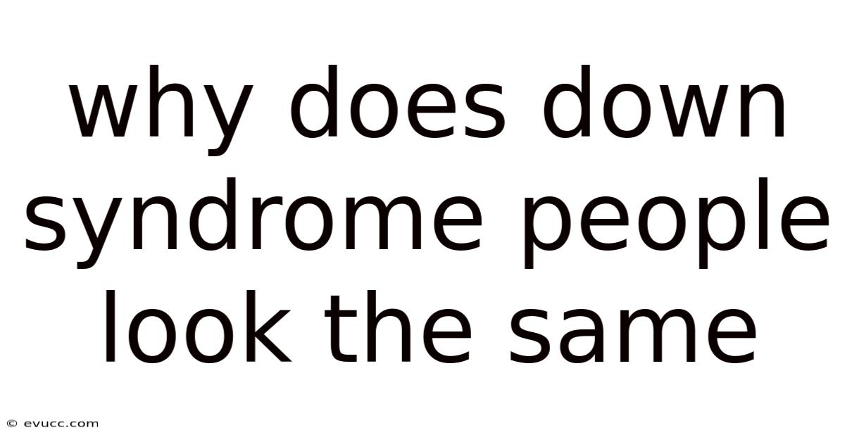 Why Does Down Syndrome People Look The Same
