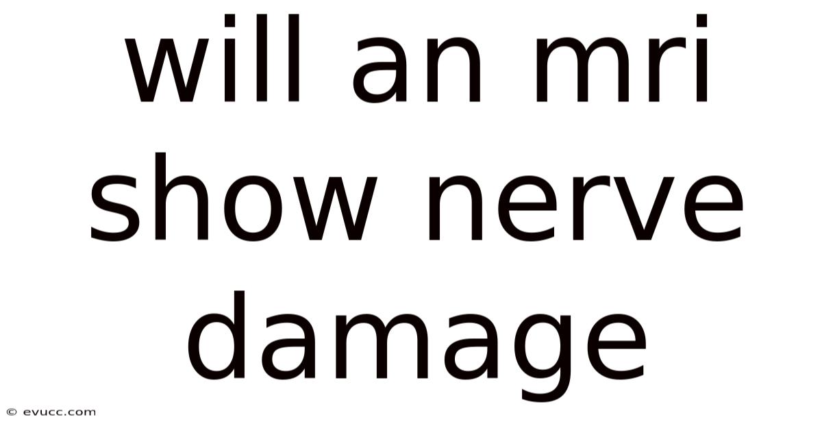 Will An Mri Show Nerve Damage
