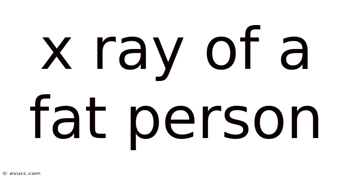 X Ray Of A Fat Person